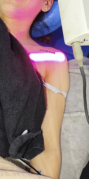 Laser Therapy at PhysioB