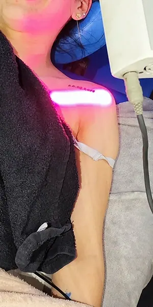 Laser Therapy at PhysioB