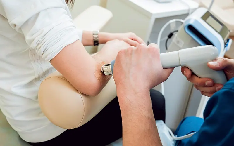 Shockwave therapy applied around the elbow